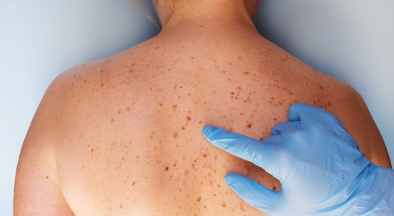 Dermatologie